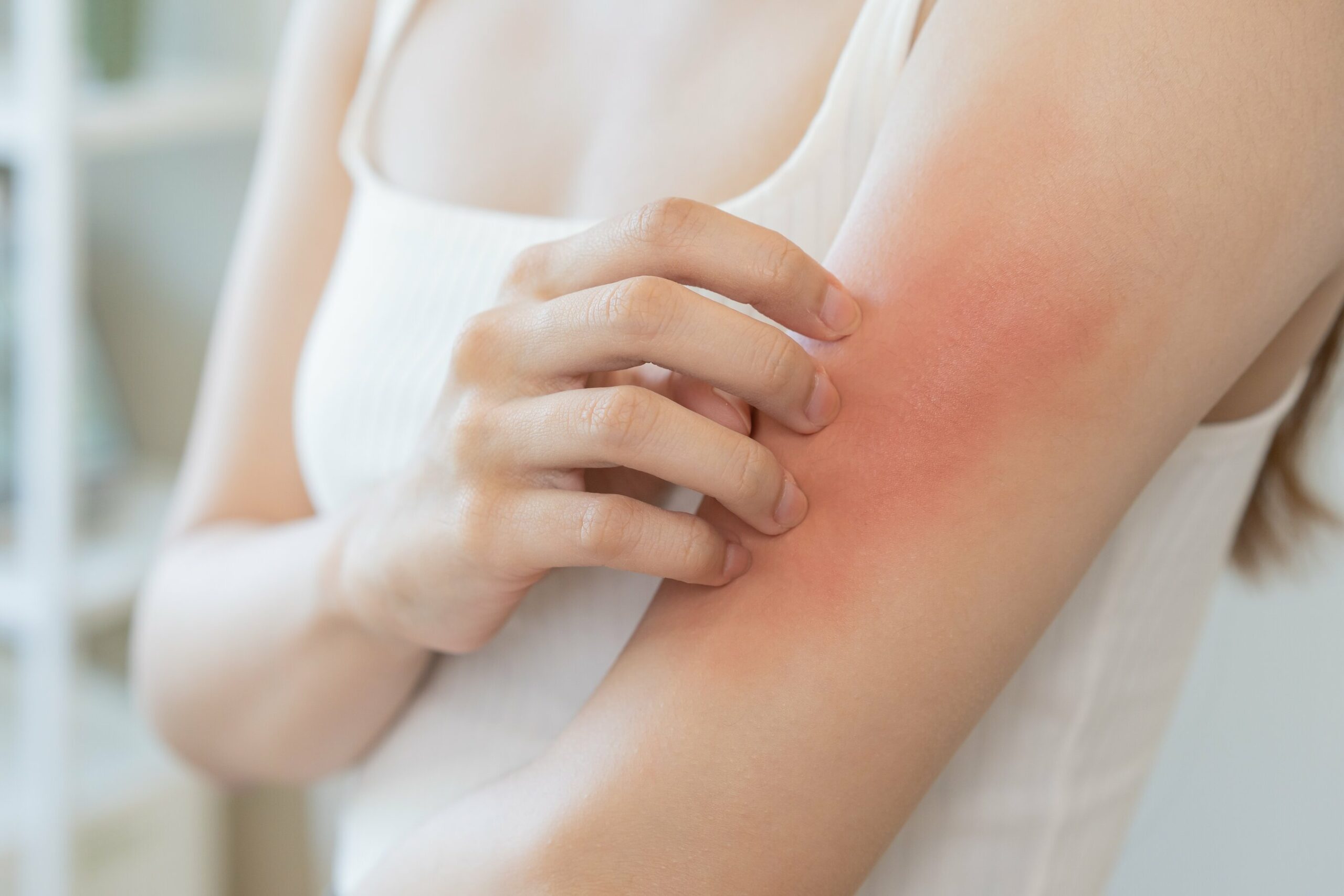 Allarme acne, prurito e secchezza in autunno: le soluzioni di skin care più efficaci