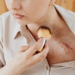 SOS cicatrici post-intervento: migliorarle con la dermocosmesi si può
